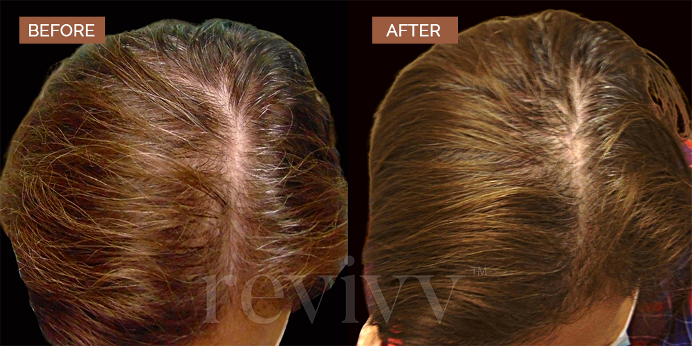 before&after2